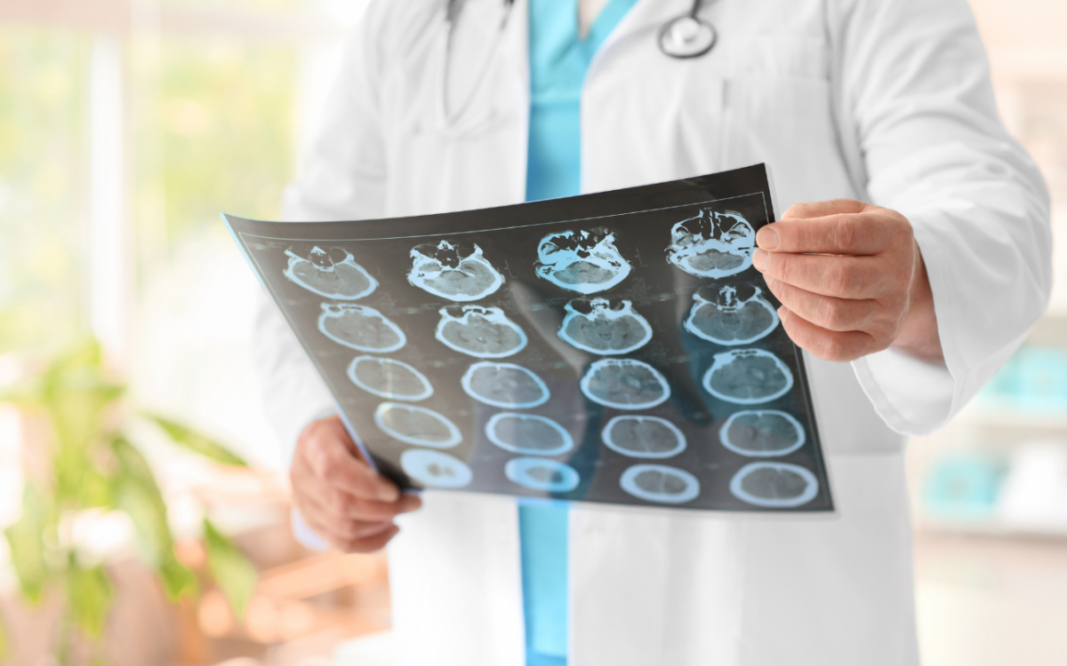 Neurological Alliance Research Confirms Growing Demand That Irish Private Hospitals With Neurology Capacity Are Well Placed to Meet