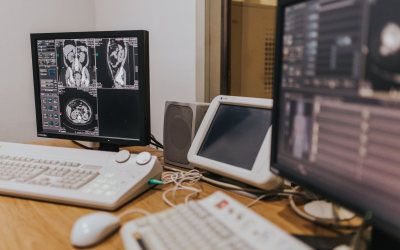 Six London NHS Trusts consolidate imaging systems on Sectra cloud platform