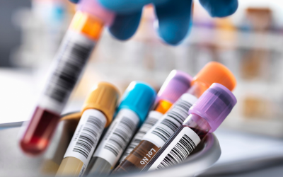 Cirdan secures £4m Salica Investments deal to drive global expansion of pathology platform